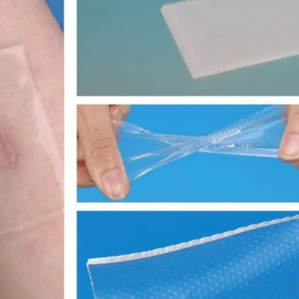 GEL SILICON VÀ MIẾNG DÁN SILICON CÓ HIỆU QUẢ TRONG VIỆC CẢI THIỆN HÌNH DẠNG VẾT MỔ SAU PHẪU THUẬT?