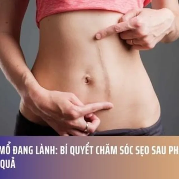 Vết Mổ Đang Lành: Bí Quyết Chăm Sóc Sẹo Sau Phẫu Thuật Hiệu Quả