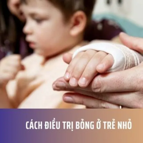 Cách điều trị bỏng ở trẻ nhỏ