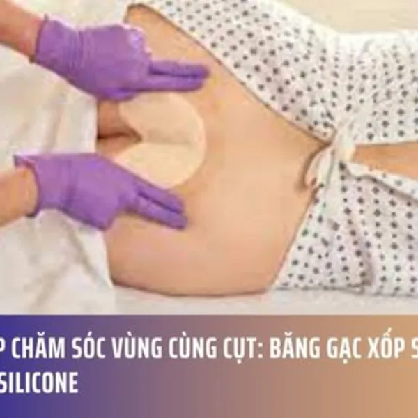 Giải Pháp Chăm Sóc Vùng Cùng Cụt: Băng Gạc Xốp Siêu Thấm Với Viền Silicone