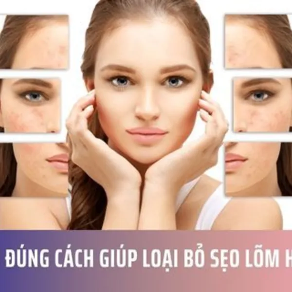 Điều Trị Đúng Cách Giúp Loại Bỏ Sẹo Lõm Hiệu Quả