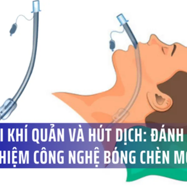 Ống nội khí quản và hút dịch: Đánh giá thử nghiệm công nghệ bóng-cuff mới