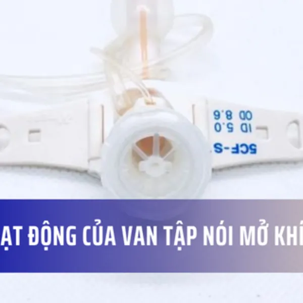 Cách thức hoạt động của van tập nói cho bệnh nhân mở khí quản
