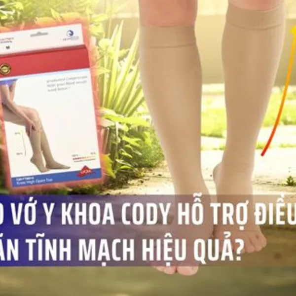 Tại sao vớ y khoa Cody hỗ trợ điều trị suy giãn tĩnh mạch hiệu quả?