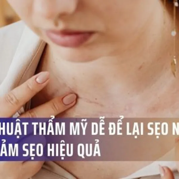Phẫu Thuật Thẩm Mỹ Dễ Để Lại Sẹo Nhất Và Cách Giảm Sẹo Hiệu Quả