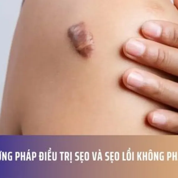 Các Phương Pháp Điều Trị Sẹo Và Sẹo Lồi Không Phẫu Thuật