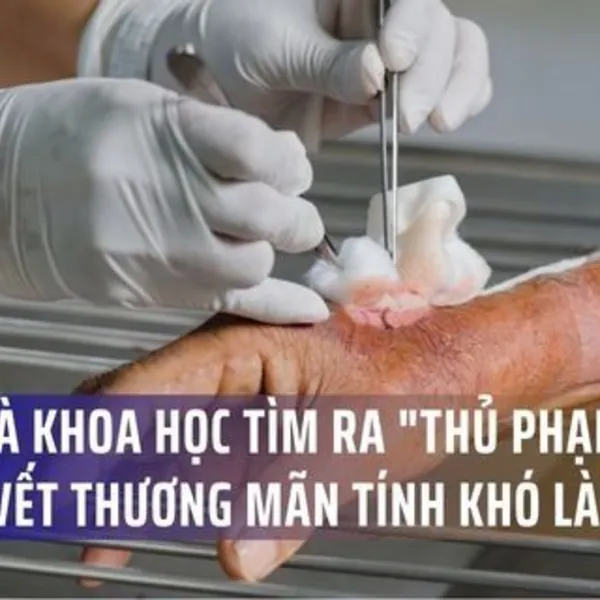 Các nhà khoa học tìm ra "thủ phạm" khiến vết thương mãn tính mãi không lành