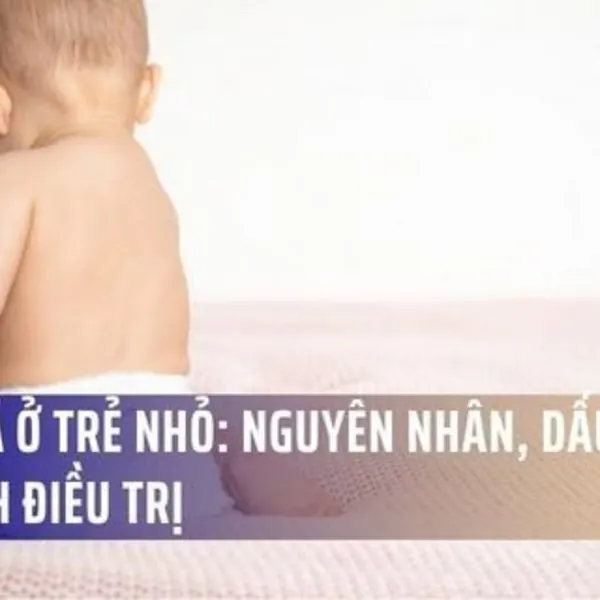 Hăm Tã Ở Trẻ Nhỏ: Nguyên Nhân, Dấu Hiệu Và Cách Điều Trị