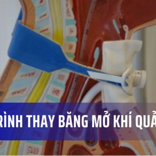 Chăm sóc bệnh nhân mở khí quản: Thay băng mở khí quản (Phần 1)