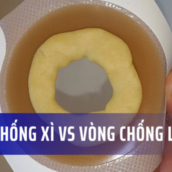 Kem chống xì và vòng chống loét dành cho hậu môn nhân tạo