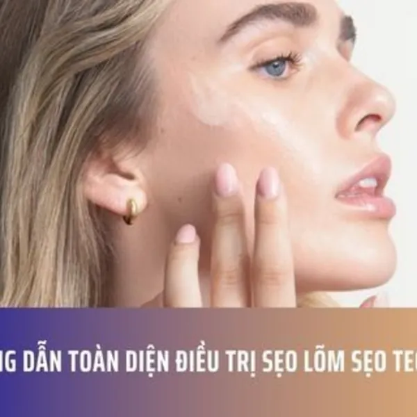 Hướng dẫn toàn diện điều trị sẹo lõm sẹo teo 2025