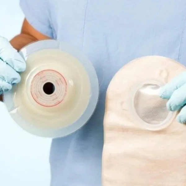 Cách lựa chọn túi hậu môn nhân tạo 2 mảnh