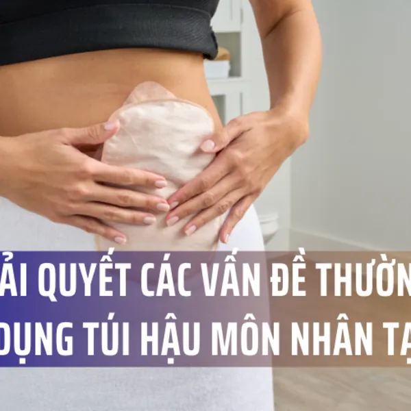 Cách Giải Quyết Các Vấn Đề Thường Gặp Khi Sử Dụng Túi Hậu Môn Nhân Tạo