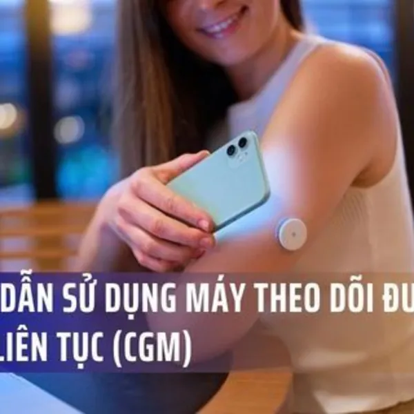 Hướng dẫn sử dụng máy theo dõi đường huyết liên tục (CGM) từ chuyên gia