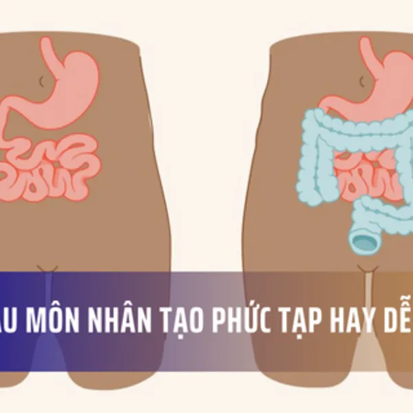 Điều gì chờ đón bạn sau phẫu thuật đóng hậu môn nhân tạo?
