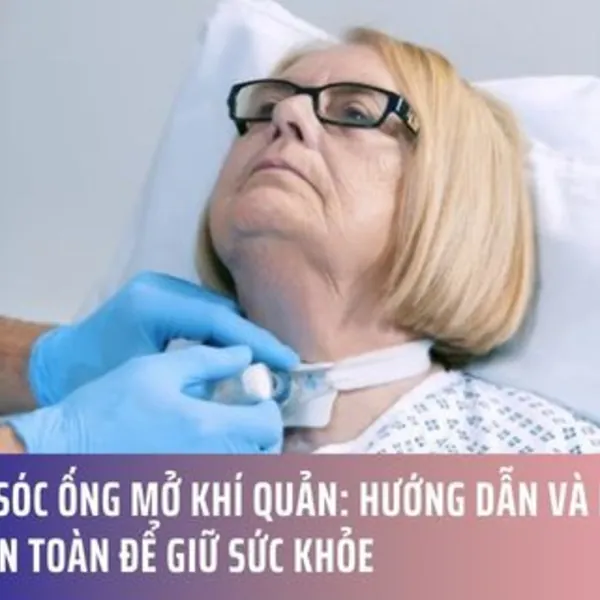 Chăm Sóc Ống Mở Khí Quản: Hướng Dẫn và Mẹo Vệ Sinh An Toàn Để Giữ Sức Khỏe