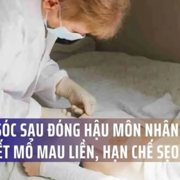 Chăm sóc sau đóng hậu môn nhân tạo giúp vết mổ mau liền, hạn chế sẹo
