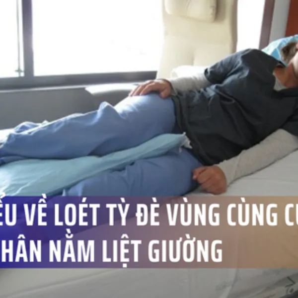 Tìm hiểu về loét da tỳ đè vùng cùng cụt ở người bệnh nằm liệt giường