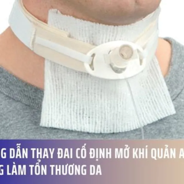 Hướng dẫn thay đai cố định mở khí quản an toàn, không làm tổn thương da