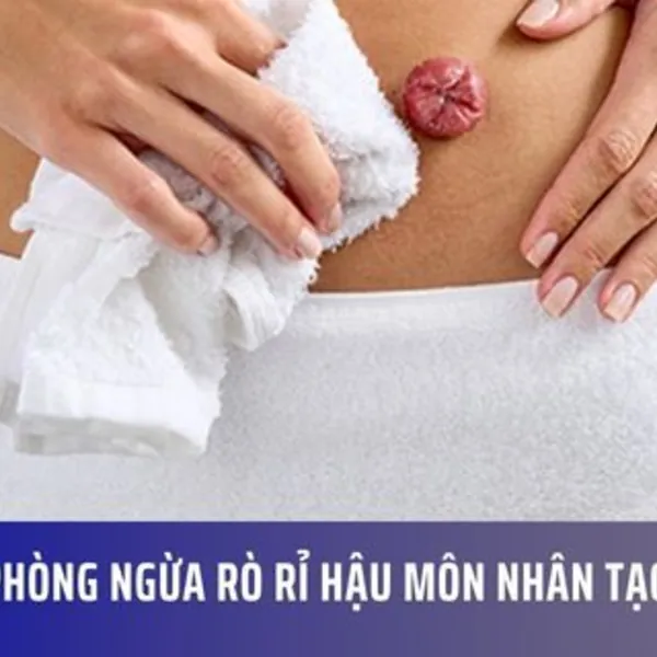 Phòng ngừa rò rỉ hậu môn nhân tạo