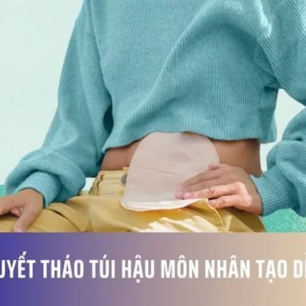 Bí Quyết Tháo Túi Hậu Môn Nhân Tạo Dễ Dàng
