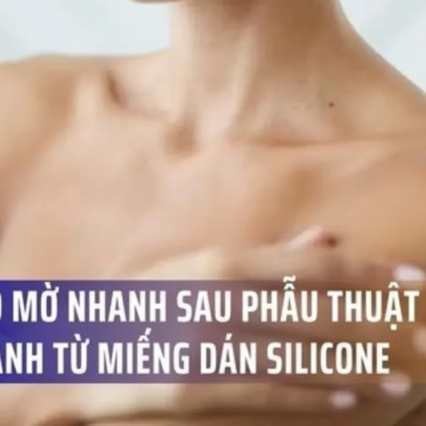 Làm Thế Nào Để Trị Sẹo Mờ Nhanh Sau Phẫu Thuật Vú? Sức Mạnh Từ Miếng Dán Silicone