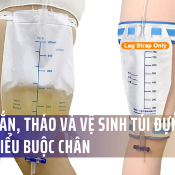 Cách gắn, tháo và vệ sinh túi đựng nước tiểu buộc chân