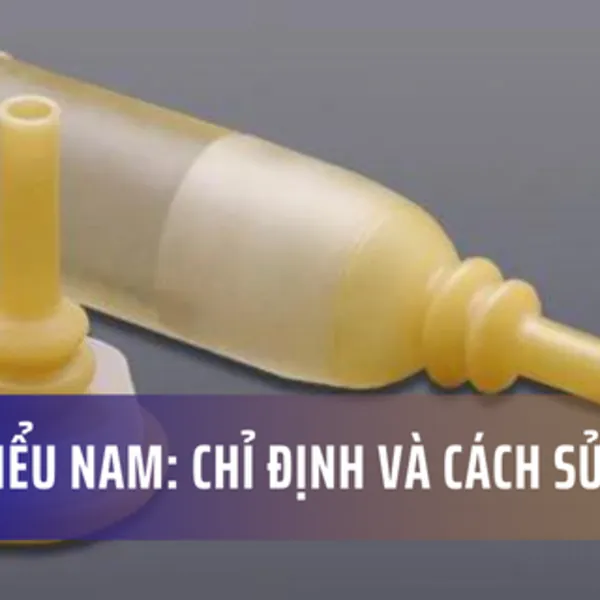 Chụp tiểu nam: Khi nào nên dùng và Sử dụng như thế nào?