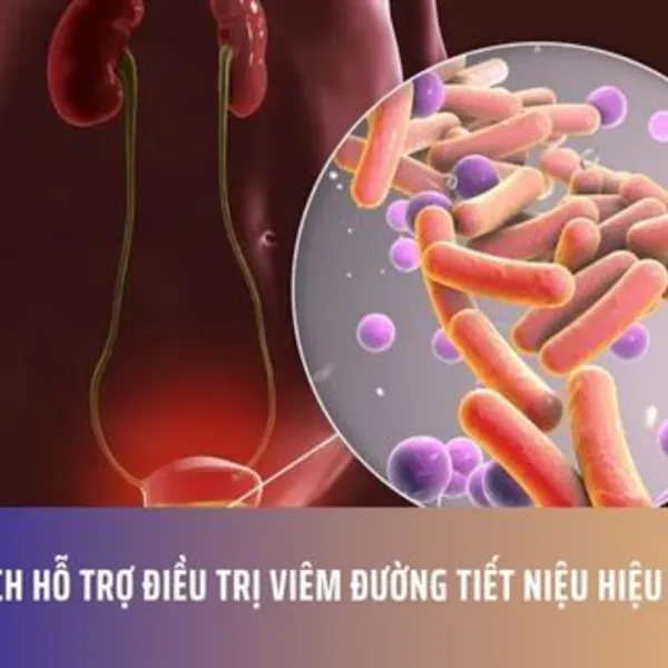5 Cách Hỗ Trợ Điều Trị Viêm Đường Tiết Niệu Hiệu Quả