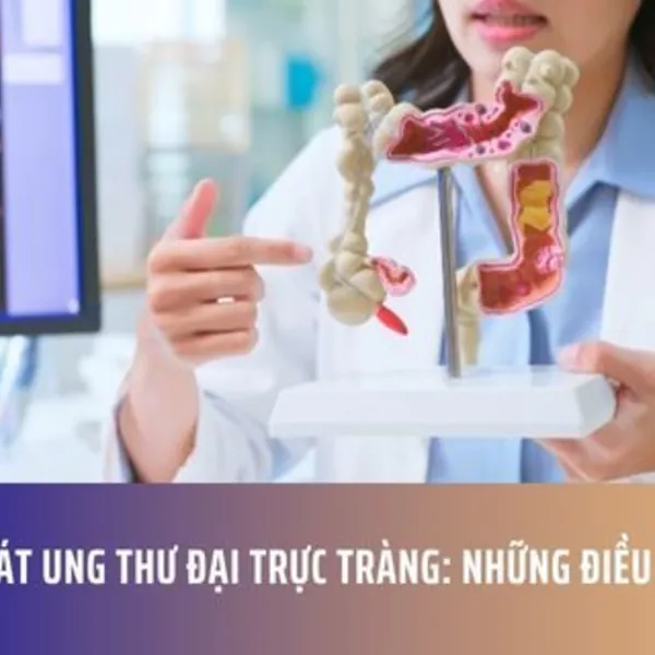 Tầm Soát Ung Thư Đại Trực Tràng: Những Điều Cần Biết