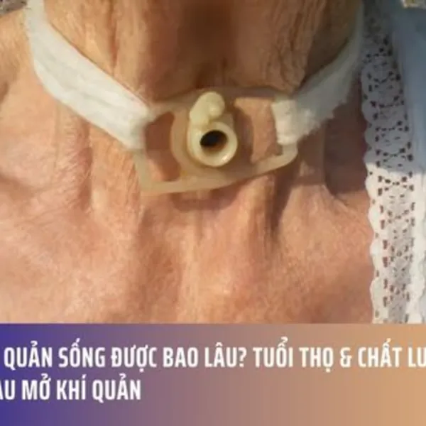 Mở Khí Quản Sống Được Bao Lâu? Tuổi Thọ & Chất Lượng Cuộc Sống Sau Mở Khí Quản