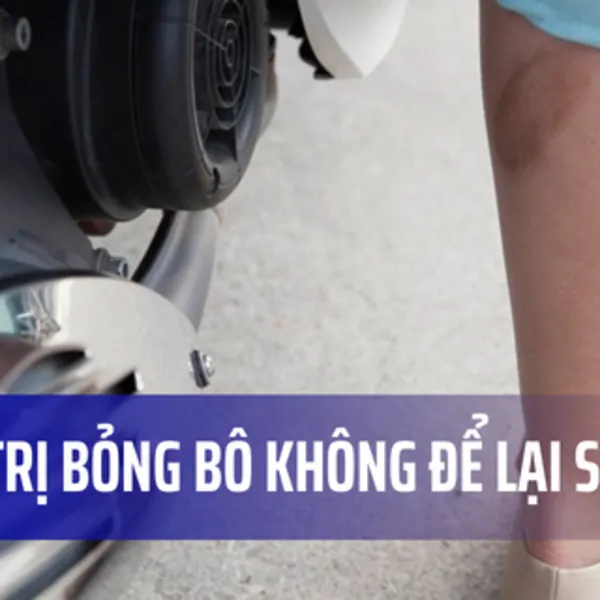 Bỏng bô có phải bỏng nhiệt không? Cách chữa trị