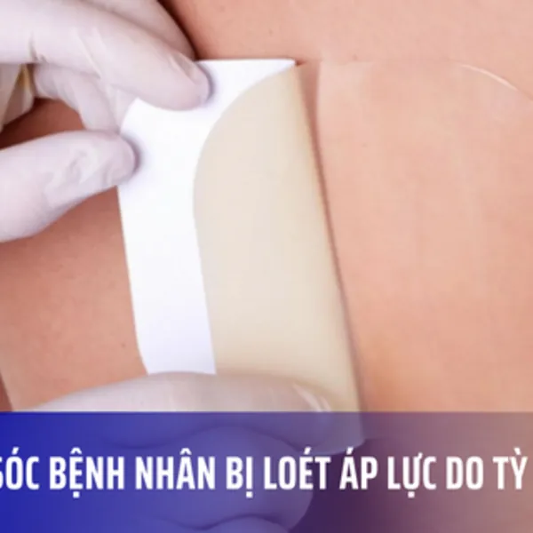 Chăm sóc bệnh nhân bị loét áp lực do tỳ đè