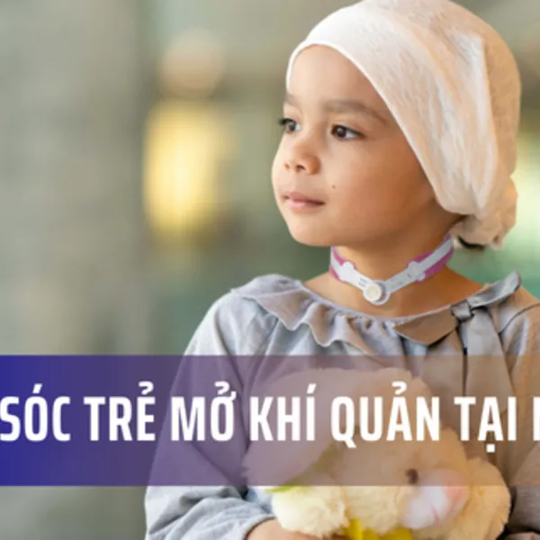 Cách chăm sóc trẻ có canuyn mở khí quản tại nhà