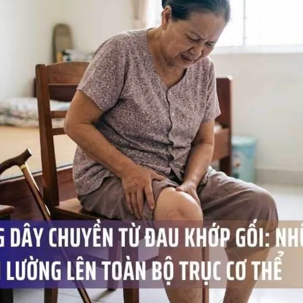Phản Ứng Dây Chuyền Từ Đau Khớp Gối: Những Hệ Lụy Khôn Lường Lên Toàn Bộ Trục Cơ Thể