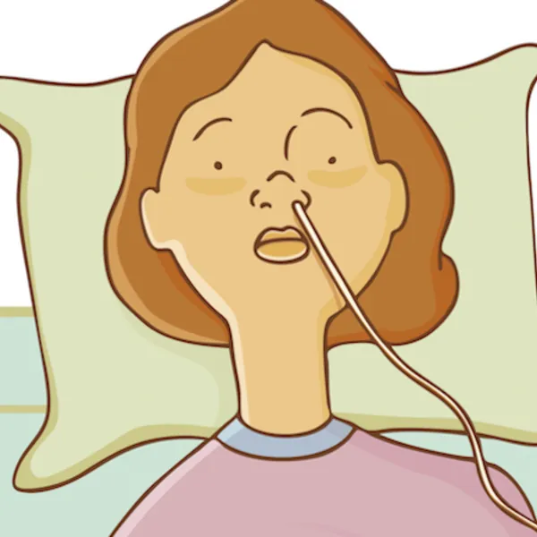 Sonde dạ dày là gì? Các biến chứng đặt sonde dạ dày nuôi ăn