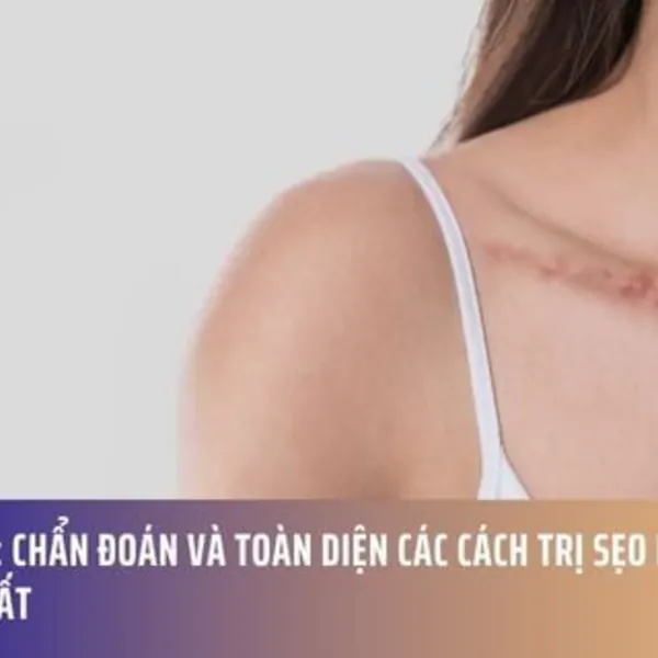Sẹo Lồi: Chẩn Đoán và Toàn Diện Các Cách Trị Sẹo Lồi Hiệu Quả Nhất