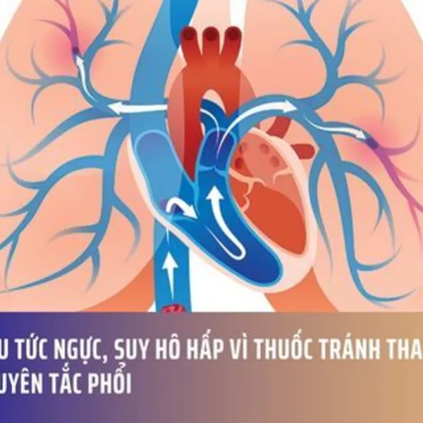 Đau Tức Ngực, Suy Hô Hấp Vì Thuốc Tránh Thai Gây Thuyên Tắc Phổi