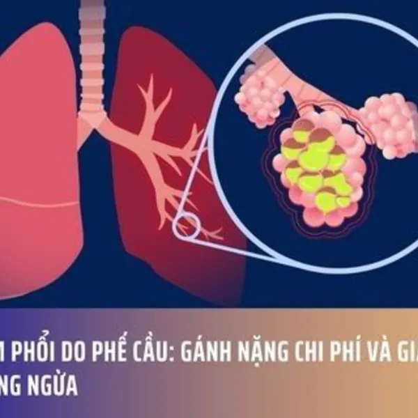 Viêm Phổi Do Phế Cầu: Gánh Nặng Chi Phí Và Giải Pháp Phòng Ngừa