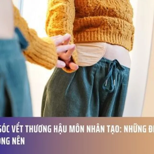Chăm Sóc Vết Thương Hậu Môn Nhân Tạo: Những Điều Nên và Không Nên