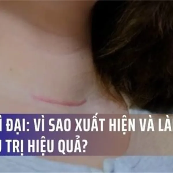 Sẹo Phì Đại: Vì Sao Xuất Hiện và Làm Sao Để Điều Trị Hiệu Quả?