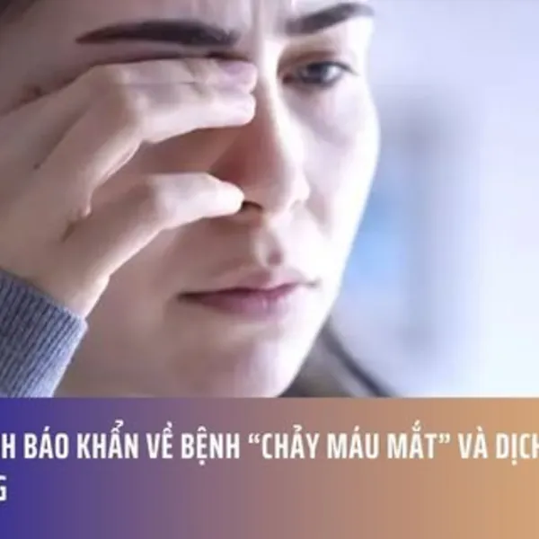 WHO Cảnh Báo Khẩn Về Bệnh “Chảy Máu Mắt” Và Dịch Tả Đang Lan Rộng