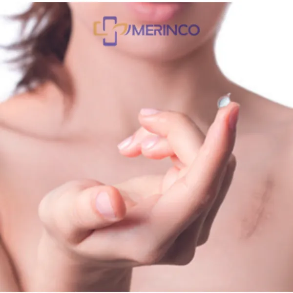 Gel trị sẹo Silicone có thể giúp điều trị sẹo mụn không?