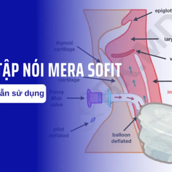 Hướng dẫn sử dụng van tập nói Mera Sofit