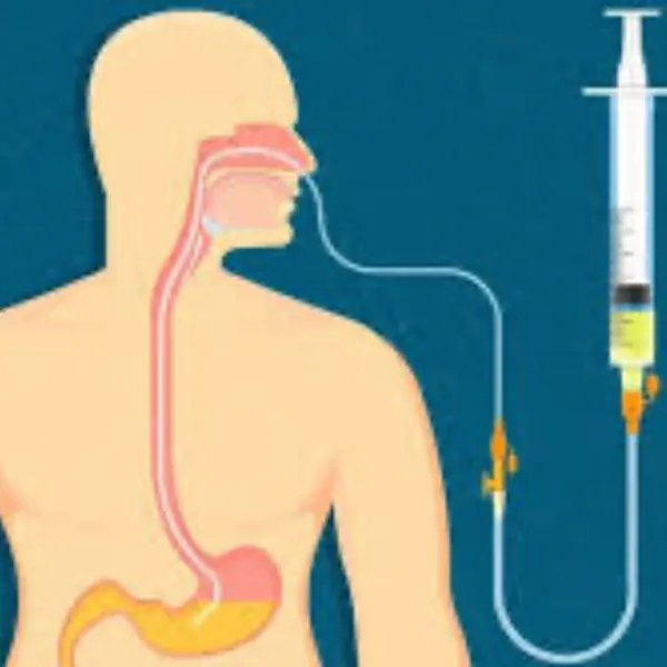 Cách uống thuốc qua ống nuôi ăn