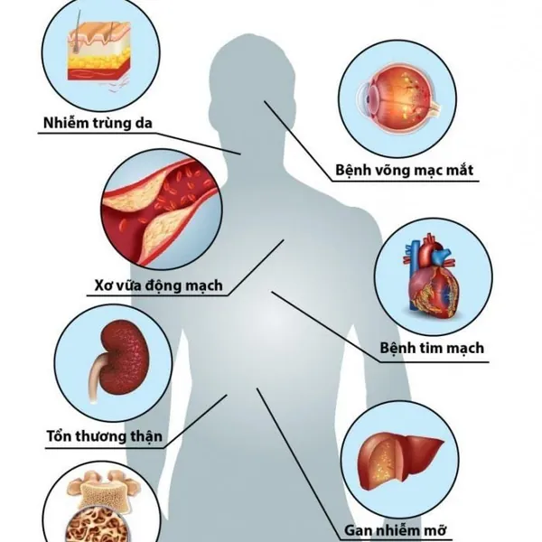 13 BIẾN CHỨNG TIỂU ĐƯỜNG NGUY HIỂM VÀ CÁCH PHÒNG NGỪA HIỆU QUẢ