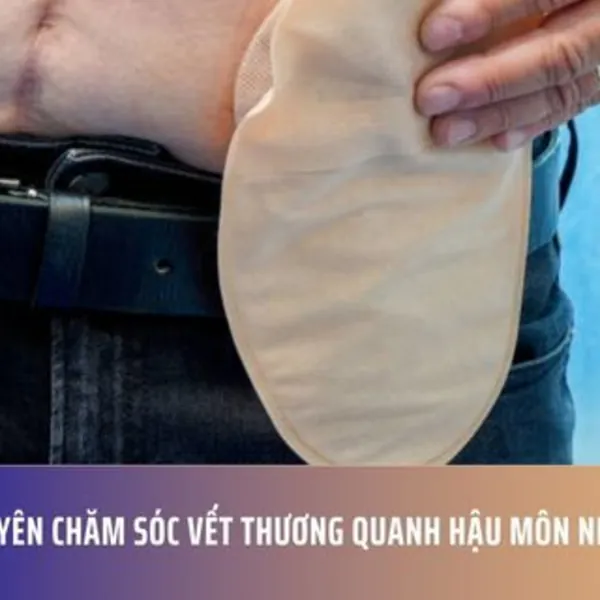 Lời khuyên chăm sóc vết thương quanh hậu môn nhân tạo