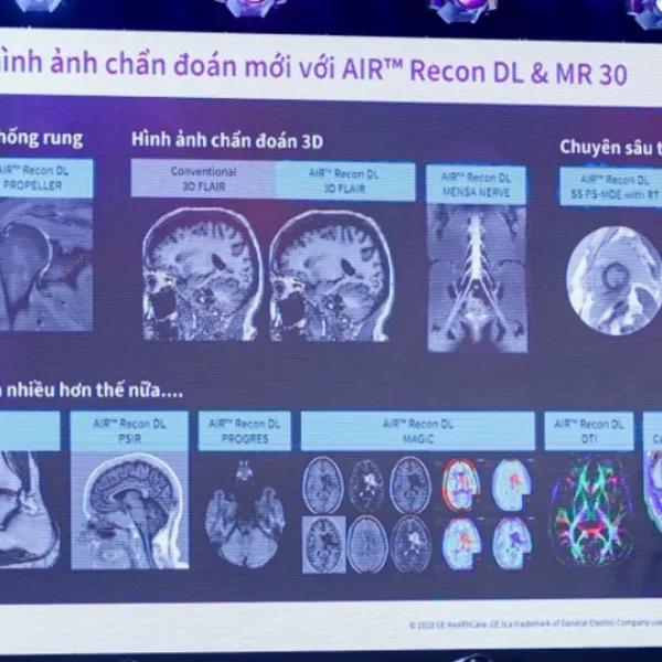 Việt Nam ứng dụng, làm chủ nhiều kỹ thuật cao trong chẩn đoán hình ảnh