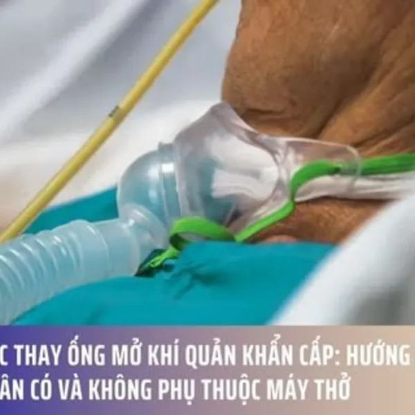 Các Bước Thay Ống Mở Khí Quản Khẩn Cấp: Hướng Dẫn Cho Bệnh Nhân Có và Không Phụ Thuộc Máy Thở