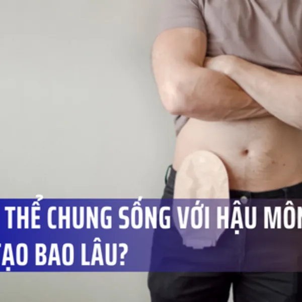Bạn có thể chung sống với hậu môn nhân tạo trong bao lâu?